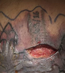 tatuaggio ferita